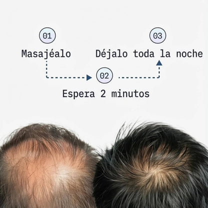 Fórmula Avanzada de Péptidos de Cobre Para El Crecimiento Del Cabello
